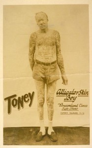 Coney Island Dreamland Side Show Freak Toney Alligator Skin Boy